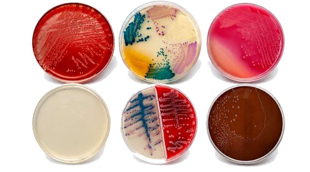 Medios de cultivo en placas con distintas coloraciones y colonias microbianas vistas desde arriba