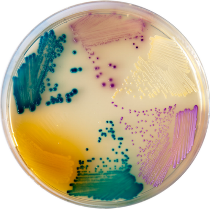 Placa de Agar ChromoAgar Orientación UTIC con colonias de distintos colores