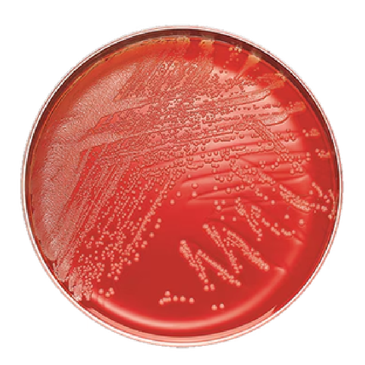 Placa de Agar Columbia Sangre 5% cordero con crecimiento microbiano