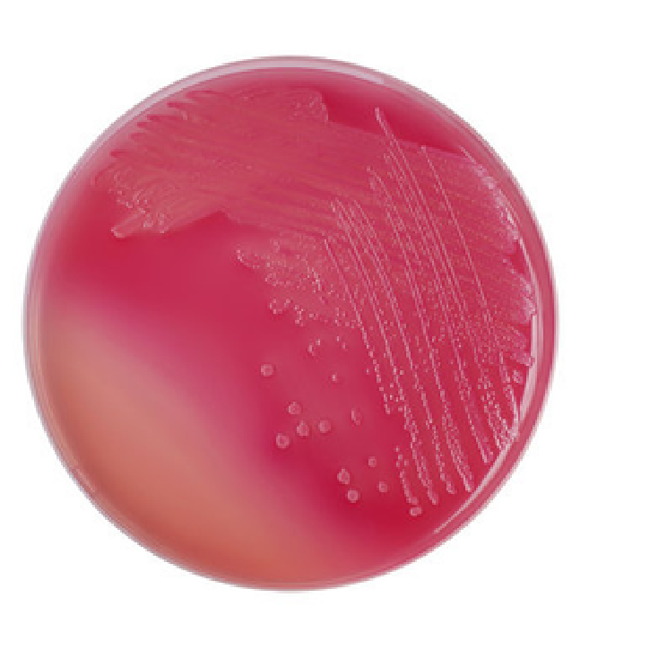 Placa de Agar MacConkey II con crecimiento bacteriano en tonos rosados